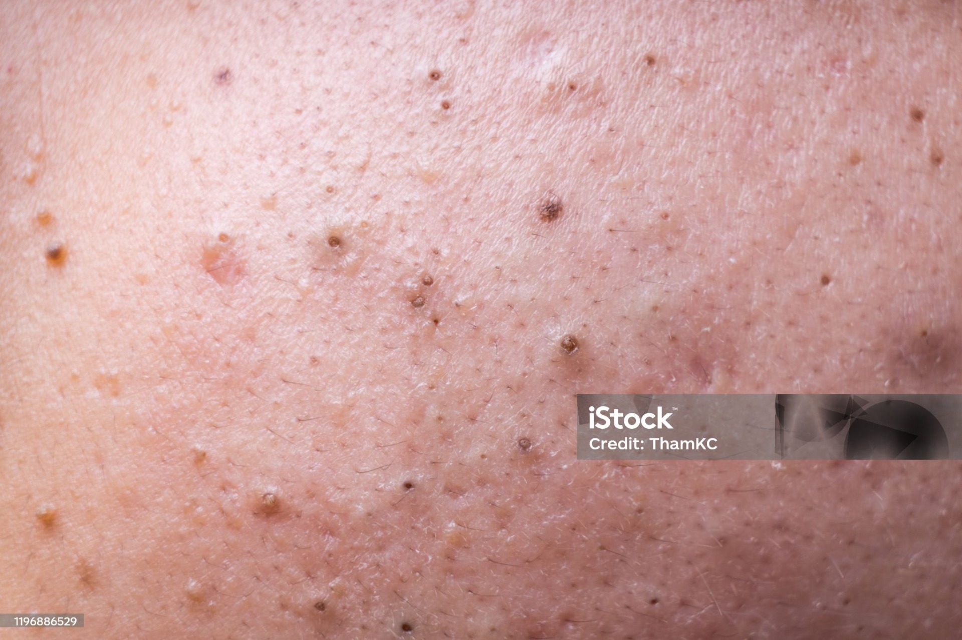 istockphoto-1196886529-2048x2048