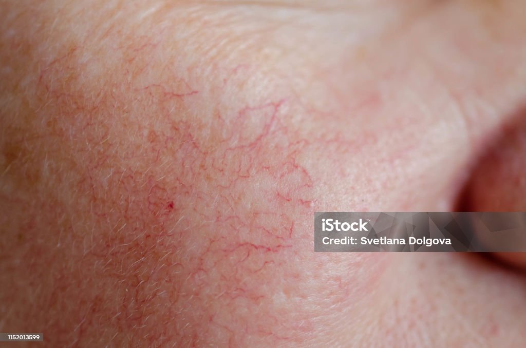 istockphoto-1152013599-1024x1024