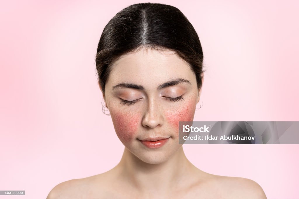 istockphoto-1313150000-1024x1024