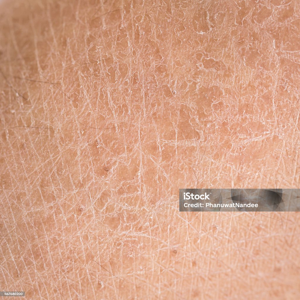 istockphoto-467680200-1024x1024
