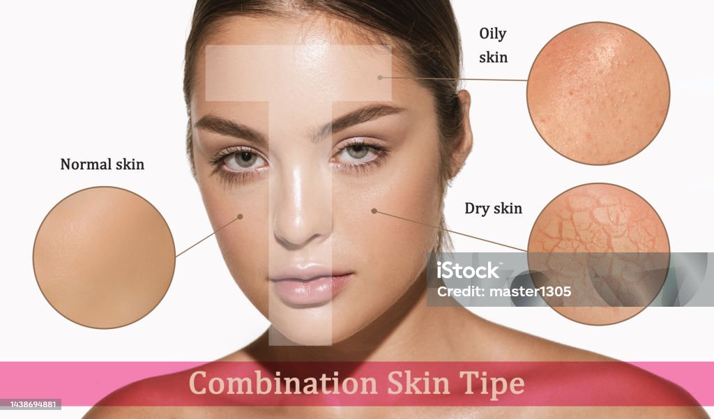 istockphoto-1438694881-1024x1024
