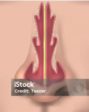 crédito Tsezer